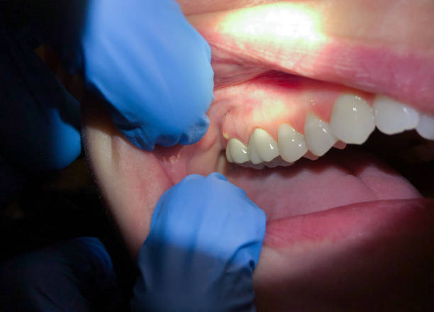 Best Urgent Tooth Repair  in Sherman, IL