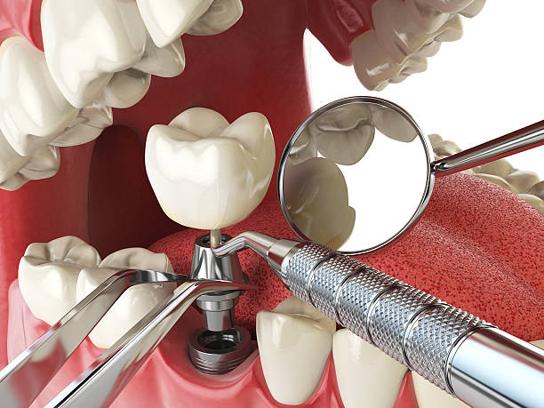 Best Emergency Dental Filling Replacement  in Sherman, IL